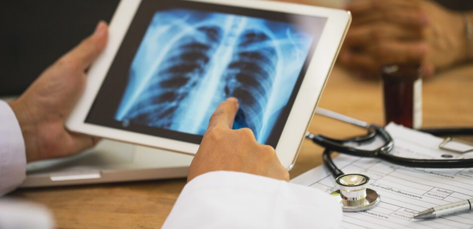 Lung cancer concept. doctor explaining results of lung check up from x-ray scan chest on digital tablet screen to patient.